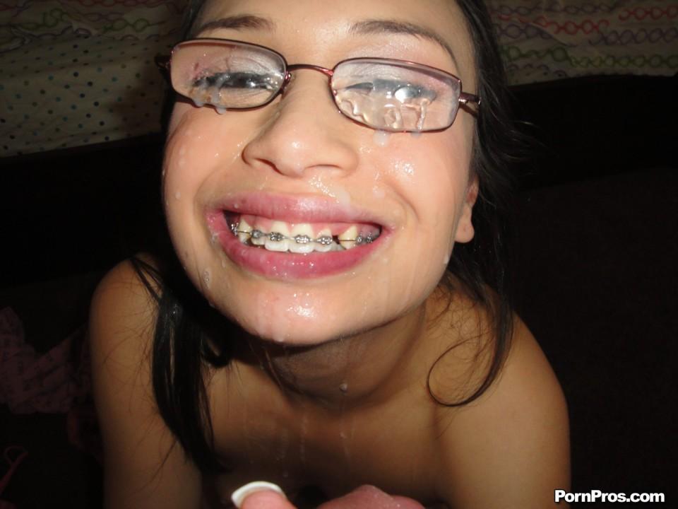 Mad M. reccomend teens braces on teeth naked gallery