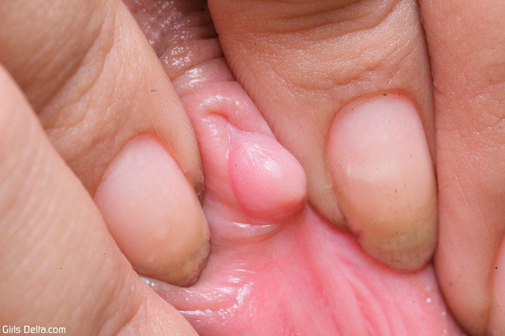 Clitoris close up