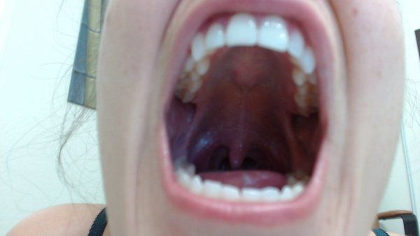 Brambleberry reccomend girl s uvula