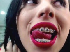 Cum swap braces