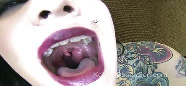 Girl s uvula