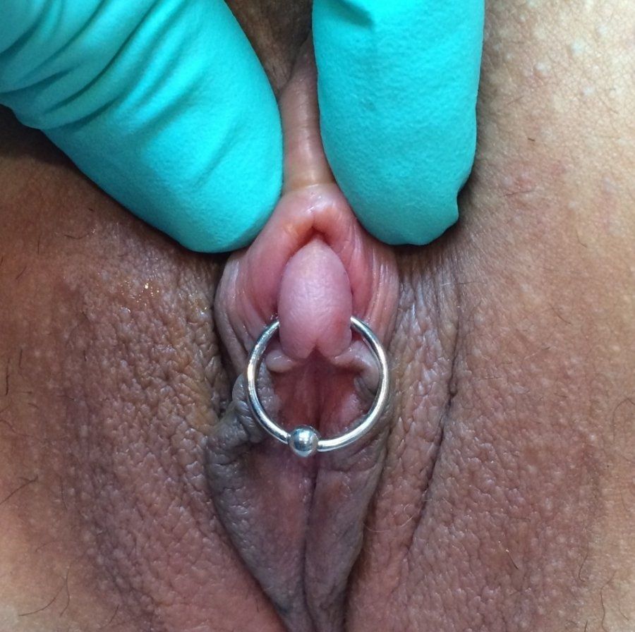 Enlarged Clit Pic