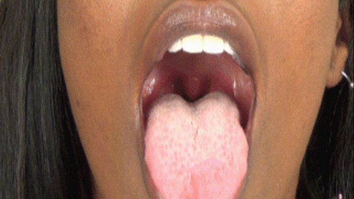 Vams reccomend mouth tongue uvula 